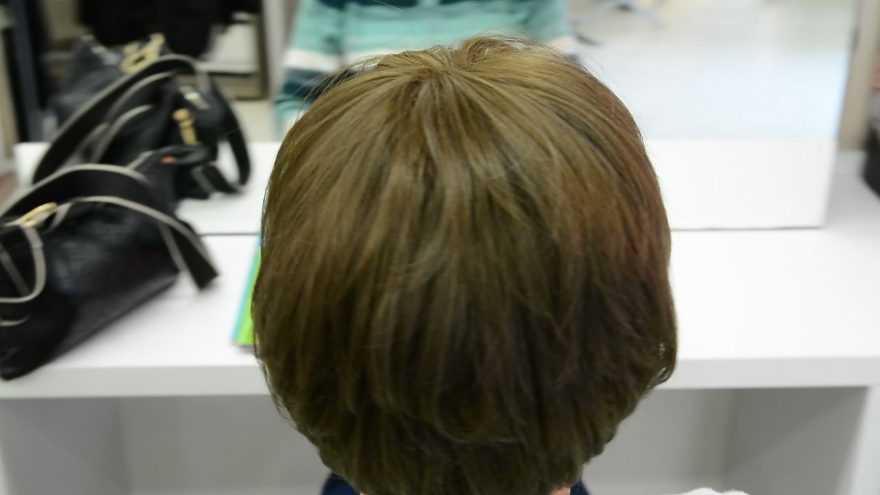 Frau mit ganz vielen Haaren nachher